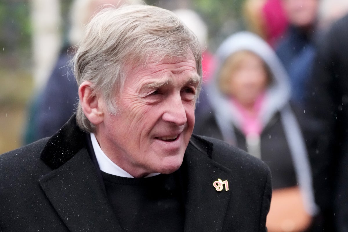 Legenda Liverpool Sir Kenny Dalglish Terima Pengobatan Kanker